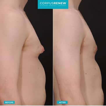 Slider image (8) CorpusRenew by Termessos Hospital